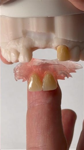 FiberFlex Nesbit for Dr. Vincent Mui in Illinois