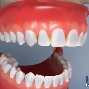 19K views · 173 reactions | The proper way to floss. | Doctors | Facebook