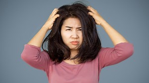 Soy dermatólogo y explico cómo controlar la caspa aplicando estos sencillos hábitos