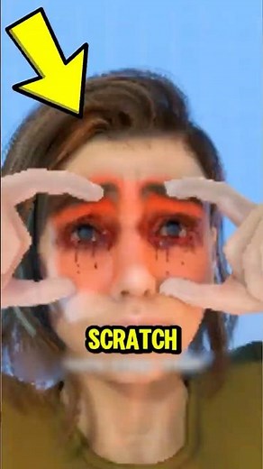 Never Rub Your Eye! The Safe Way to Remove Something Stuck Inside