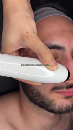 Transform Your Skin with a Pore Vacuum