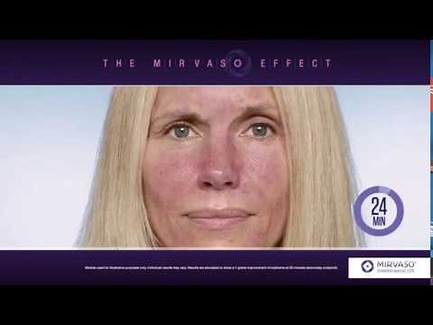 MIRVASO Anti Rosacea Gel