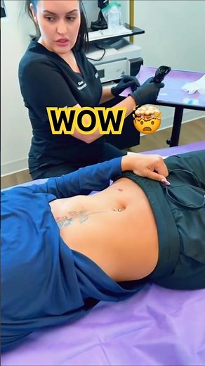 I Coded After Surgery” | Near-Death Experience Story