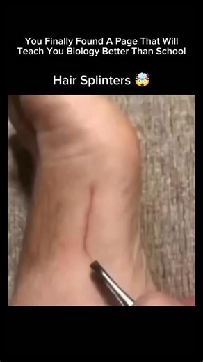 Explaining Biology on Instagram: "Hair splinters are tiny, sharp fragments of hair that pierce the skin—usually on hands, feet, neck, or between fingers. They happen most often to barbers, stylists, pet groomers, or anyone handling freshly cut hair. Because cut hair is stiff and needle-sharp, it can slip into the skin, causing itching, redness, pain, and sometimes infection if not removed. Quick tips: rinse the area, use clean tweezers, apply antiseptic, and cover if irritated. “Ever felt a stin