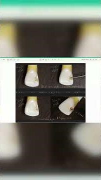 New 2026 Dental Board Exam Changes Explained