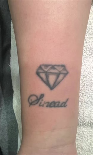 Tattoo Removal FAQs — Let's Clear Things Up * How does my tattoo look after laser tattoo removal? Right after treatment, the area may look slightly red, frosted (white), or swollen - totally normal! Over the next few weeks, the ink gradually fades as your body breaks it down. * Does it hurt? Most people say it feels like a quick snap of an elastic band. It's fast, manageable, and we use cooling methods to keep you as comfortable as possible. What's the aftercare? • Keep the area clean and dry • 