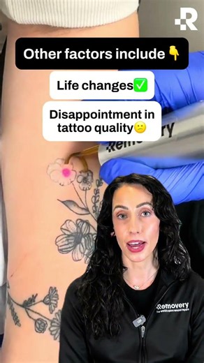Why Do People Get Tattoos Removed? 🤔 #Shorts