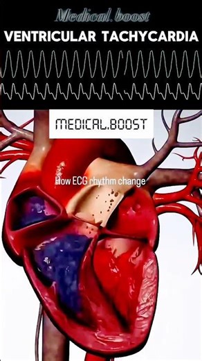 The human heart working in machine and working time tune