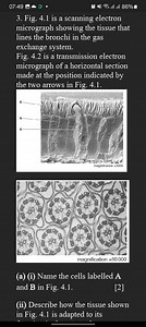07:493. Fig. 4.1 is a scanning electron micrograph showing the... | Filo
