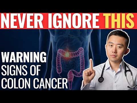 Warning Signs of Colon Cancer You Should Never Ignore