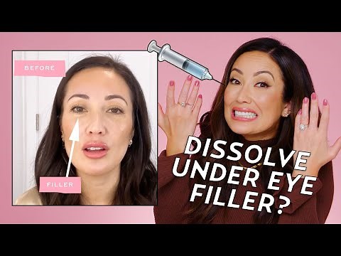 Why I Dissolved My Under Eye Filler | Skincare with Susan Yara