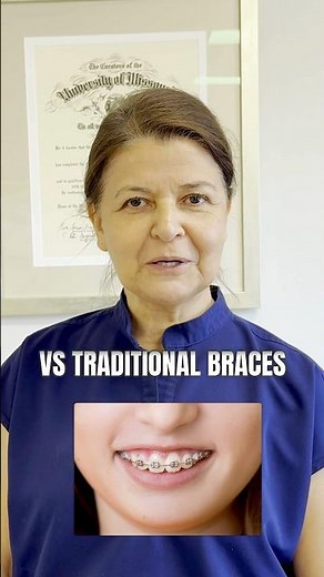 Fastbraces vs traditional braces, which one is better?#fastbraces #braces #bracesoff