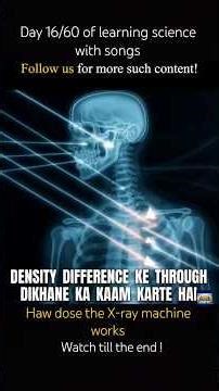 An X‑ray machine works by using high-energy electromagnetic radiation to see inside the body.#xray