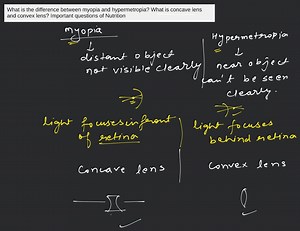 What is the difference between myopia and hypermetropia? What i... | Filo