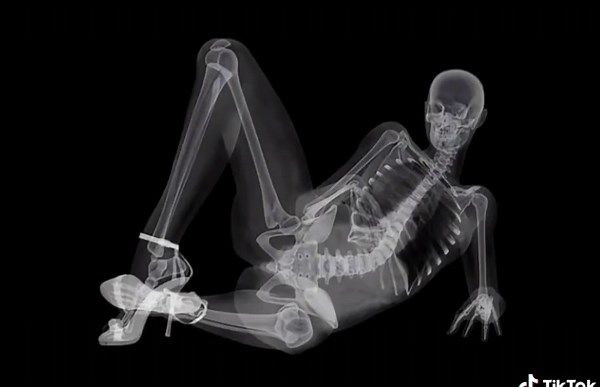 Innovative X-Ray Pin-Up Calendar by EIZO