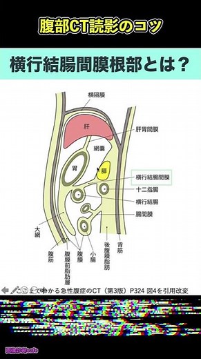 横行結腸間膜根部とは？急性膵炎のCT grade評価で重要【腹部CT読影のコツ】#shorts