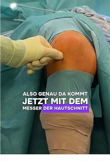 Knie-Arthroskopie: So läuft die Gelenksspiegelung ab