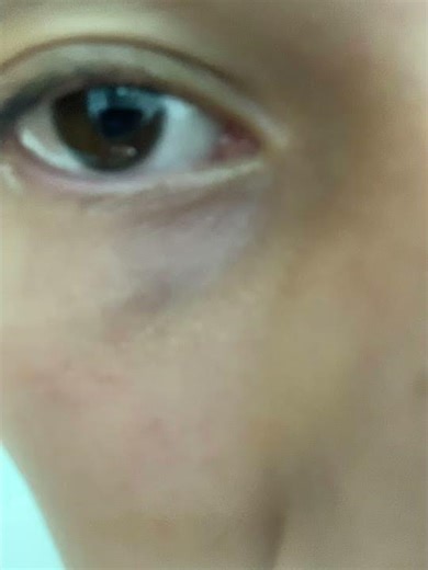 DIA 6 - Biokinesis olho claro