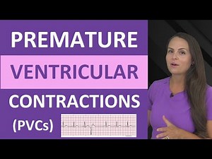 Premature Ventricular Contractions (PVCs) ECG Nursing NCLEX Bigeminy, Trigeminy
