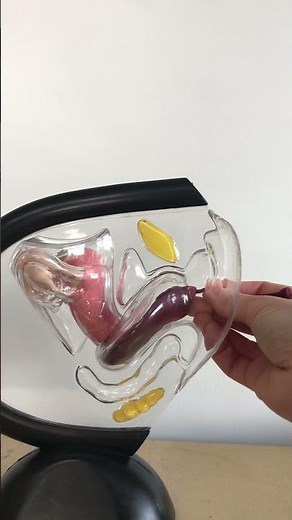 3 reasons your Menstrual Disc is Leaking🩸