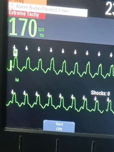 Understanding Patient Rhythms in Cardiology