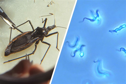 What is Chagas Disease? The Scary Truth About the ‘Kissing Bug’ Parasite Spreading in the US