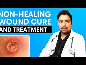 Non-Healing Wound Cure & Treatment Explained by Dr. Hemant Sharma | Chronic Wound Management
