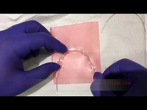 FF005. Orthodontic Arch Wire Contouring to Patient Arch Form