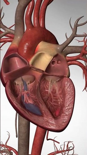 What happens during a Cardiac Arrest of the Heart #cardiacarrest #heartattack #heartdisease