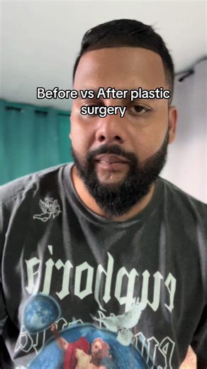 Before and After Plastic Surgery Transformation