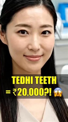 Japan Mein Tedhi Teeth Rakhna FASHION Hai?! 😱 #shorts
