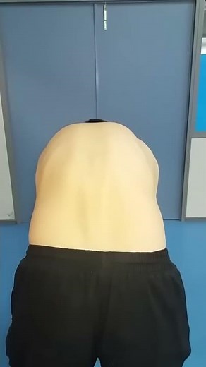 Test de ADAMS (Escoliosis)