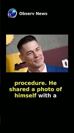 John Cena Undergoes Second Hair Transplant, Shares Bald Transformation