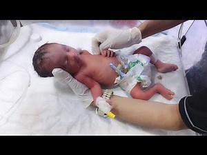 Baby massage for healthy growth #BabyMassage #BabyCare #ParentingTips #BabyGrowth #NICUCare