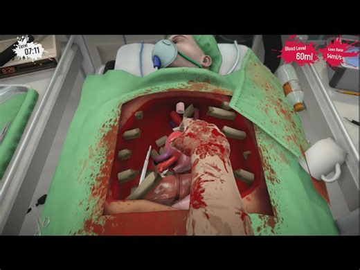Surgeon Simulator PS4 - Buzzer heart-beater!