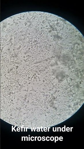 kefir water under microscope #kefir #kefirgrains #kefirwaterundermicroscope #probiotic