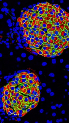 Daily CRISPR Updates | Syntax Bio recently announced it received up to $856,250 to advance pancreatic beta cell therapy targeting type 1 diabetes using its... | Instagram