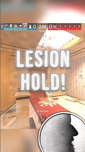 The Easy LESION Hatch HOLD! #rainbowsixsiege #xbox #r6