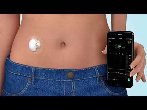 El monitoreo continuo de su glucosa