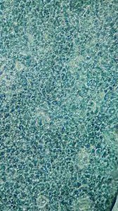 Pus Under Microscope: Exploring Zit Popping and Bacteria