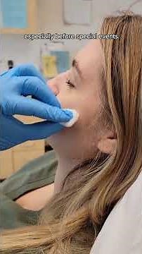 HOW TO: How a Dermatologist gets rid of a painful acne cyst in 48 hours!