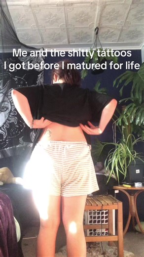 #whoops I wanna get them removed hahaha