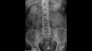 x-ray thoraco-lumbar human structure with pelvic bone