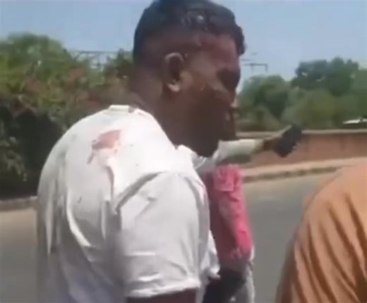 The lone survivor of the #AirIndia plane Crash in India 'Ramesh Vishwas Kumar' from Daman Diu. Walked out from hell fire. | The News Now