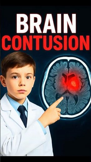 🧠 CT Scan Head Injury Findings | Brain Hemorrhage Explained #shorts