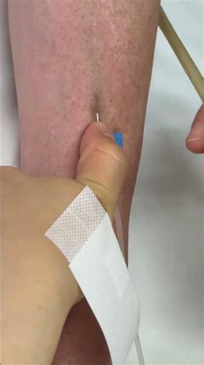 Intramuscular Injection Technique Explained | Safe IM Injection Step-by-Step | Nurse Guide Class 31