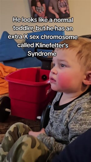 Understanding Klinefelter's Syndrome in Toddlers