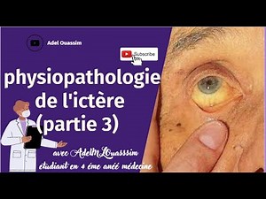 Physiopathologie de l'ictère - PARTIE 3 - Ictère a bilirubine conjugué.