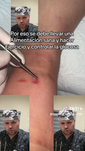Prevención y cuidado del pie diabético