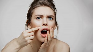 5 Anti-Inflammatory Herbs That Can Help Treat Skin Inflammation